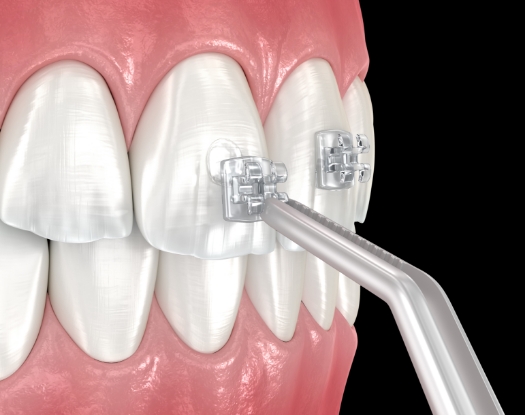 라미네이트 이미지