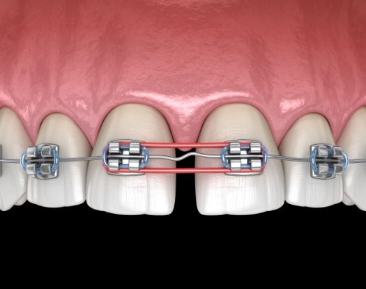 라미네이트 이미지